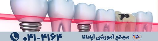 آموزش دستیاری
